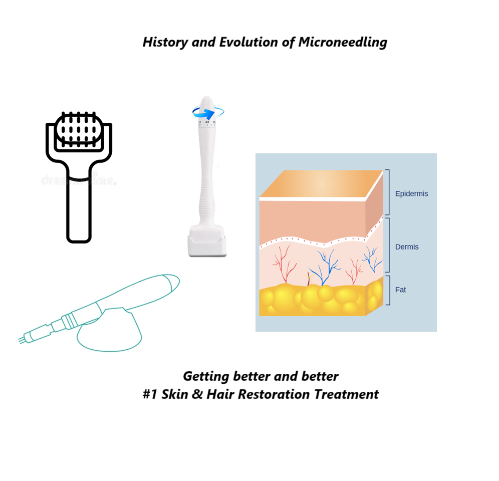 History of Evolution of Microneedling (CIT)