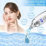 Portable Diamond Micro Dermabrasion Machine