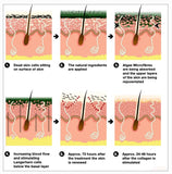 How does an algae peel work?