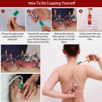 48 Cups - Hijama Cupping Set