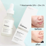 The Ordinary - Niacinamide 10% + Zinc 1% (30ml)