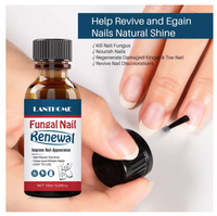 Nail Fungal/Repair Treatment